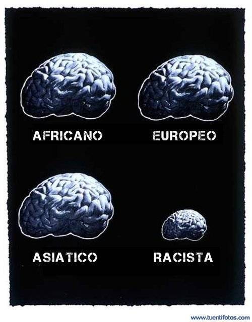 Cerebro Racista