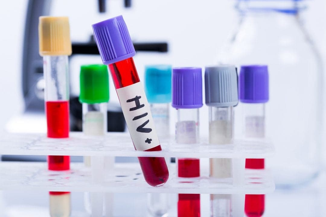 Ministério da Saúde começa distribuição de teste oral de HIV