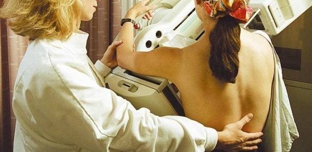 mamografia-cancer-de-mama-exame-de-mamografia-hospital-