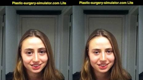 Blogueira se submeteu a um simulador de resultado de cirurgia plástica