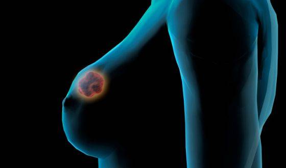 Uma nova alternativa para preservar a fertilidade frente ao câncer de mama