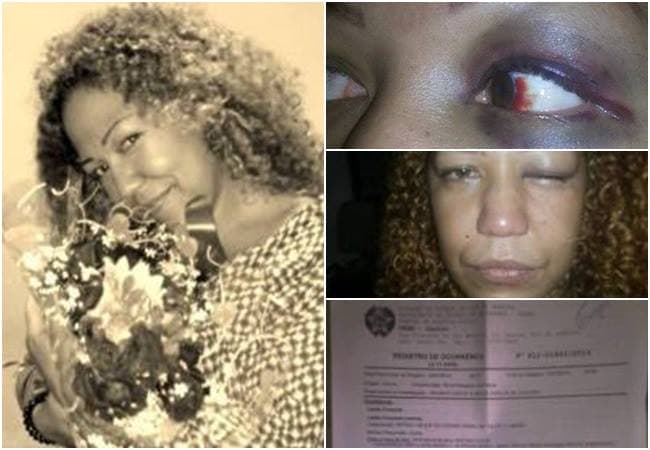 Diferentemente de outras vítimas de violência doméstica cantora usou o Facebook para relatar agressão