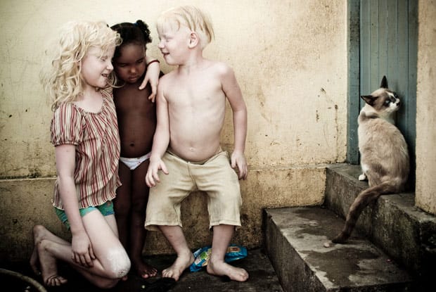 Foto dos irmãos albinos destacou talento do fotógrafo para o mundo (Foto: Alexandre Severo/JC Imagem)