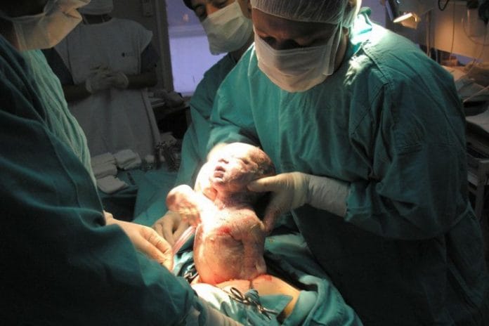 Em todo o mundo, o Brasil é o país com o maior número de cirurgias cesarianas