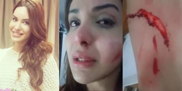 Viviany Beleboni, atriz ‘crucificada’ na Parada Gay diz ter sido agredida com faca em SP