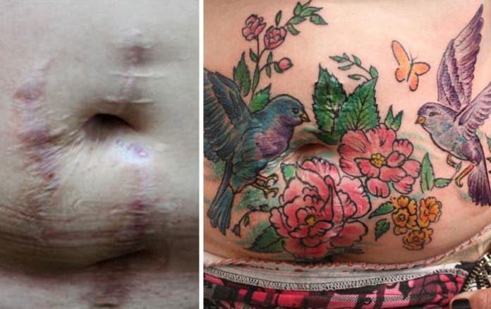 tatuagens-flavia-carvalho-de-sobreviventes-da-violencia-e-cancer-5