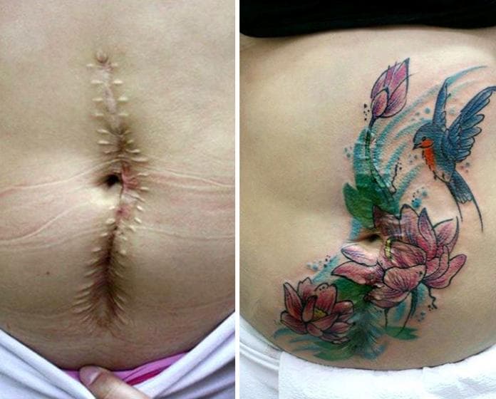 tatuagens-flavia-carvalho-de-sobreviventes-da-violencia-e-cancer-6