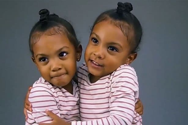 O mundo desta menina caiu ao descobrir que ela é 1 minuto mais nova que sua irmã gêmea (VÍDEO)