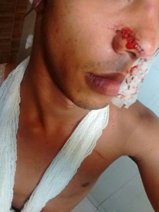 Drag queen é agredida com golpes de foice em São Gonçalo
