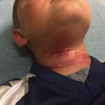 Garoto de 8 anos é enforcado por adolescente em ataque racista