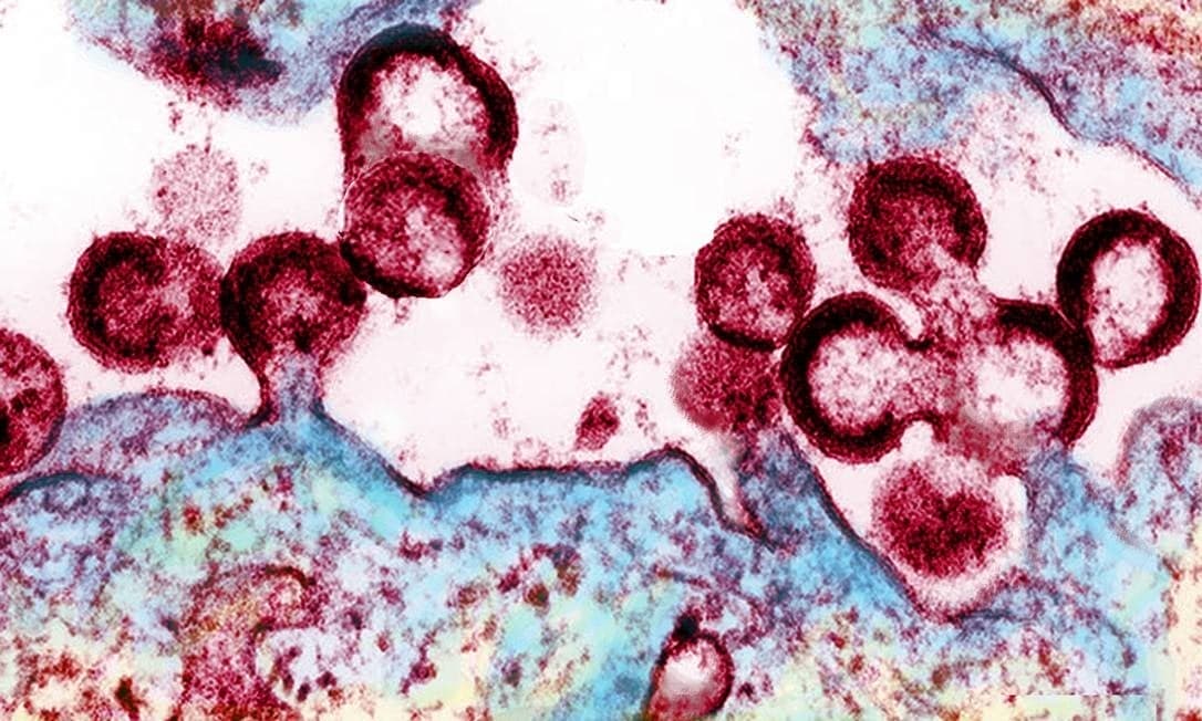 Cientistas descobrem ‘caminho’ para eliminar HIV totalmente do corpo