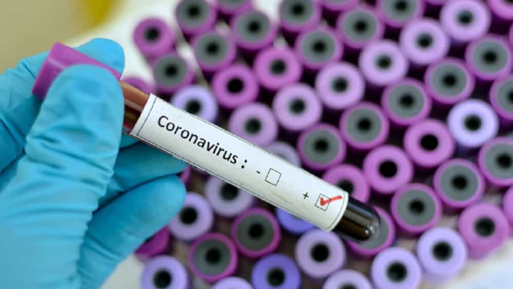 Pandemia de coronavírus já atinge mais de dois terços da África