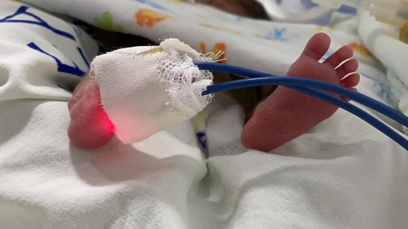 Brasil tem ‘legião de bebês prematuros’ com alta de covid em grávidas