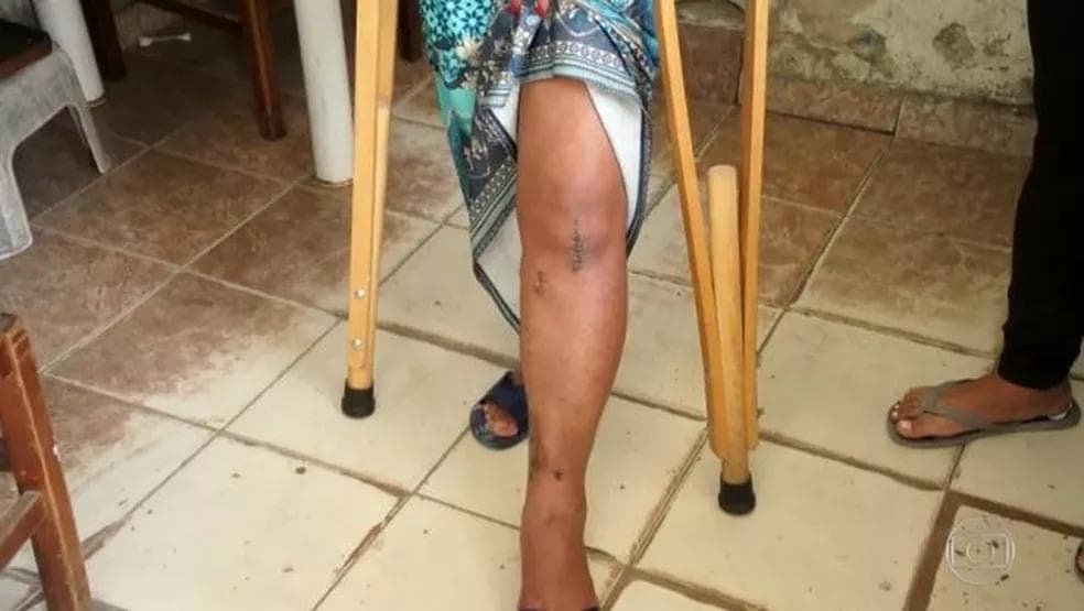 Mulher negra que teve pescoço pisado por PM diz que se sente injustiçada com absolvição: ‘Envergonhada de ser brasileira’