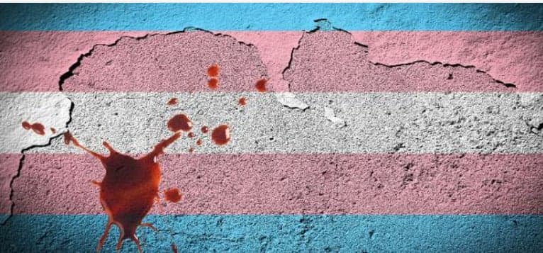 Com bala alojada no rosto, mulher trans relata que sofreu tentativa de homicídio após ser alvo de homofobia e intolerância religiosa